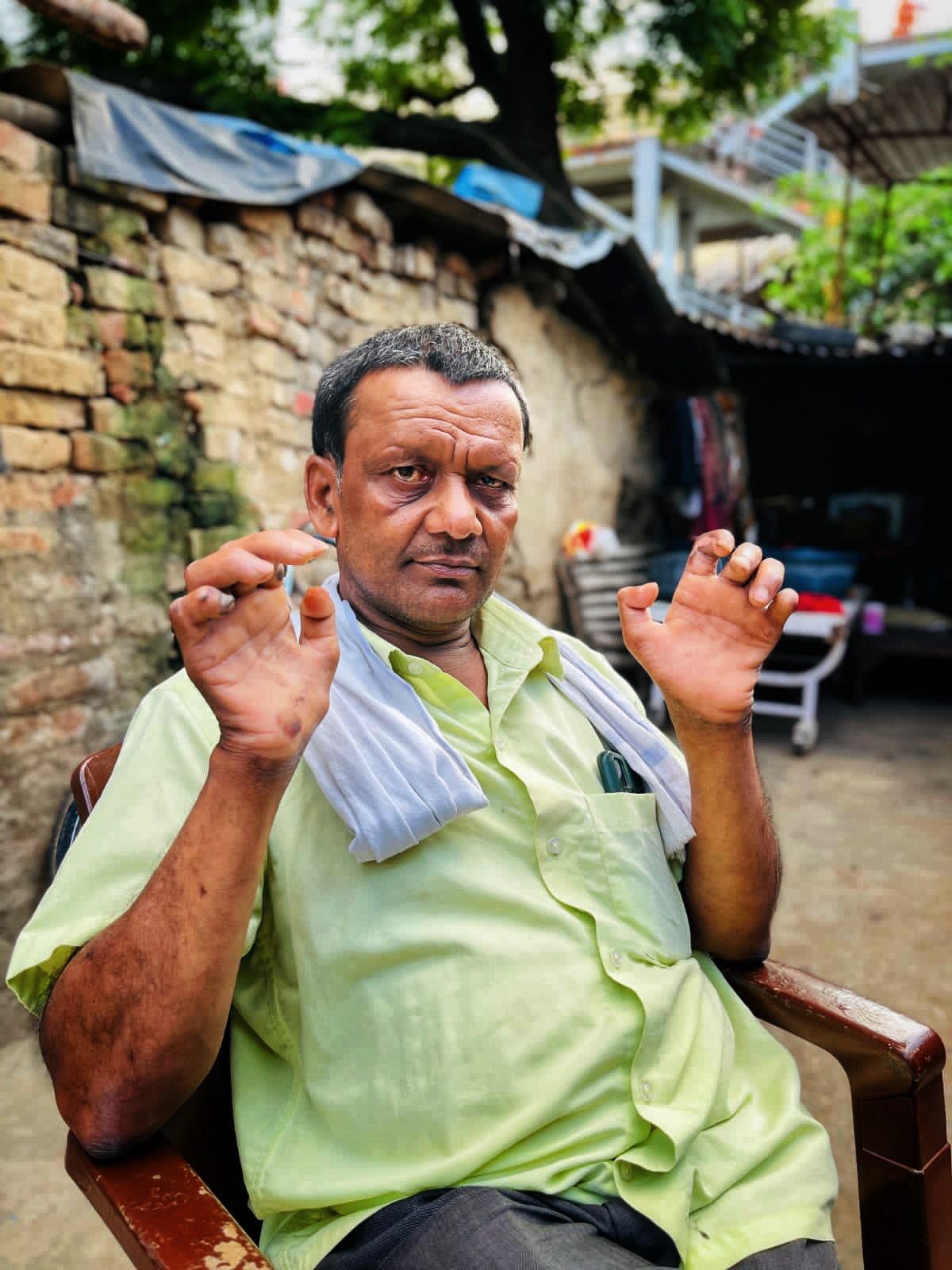 From Leprosy Patient to Community Champion: The Inspiring Story of ...